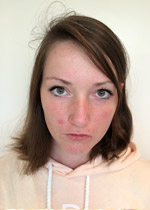 Vorher